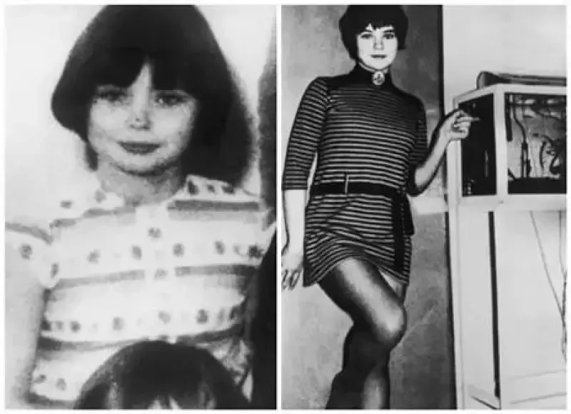 Two black and white photos of a woman in a striped dress